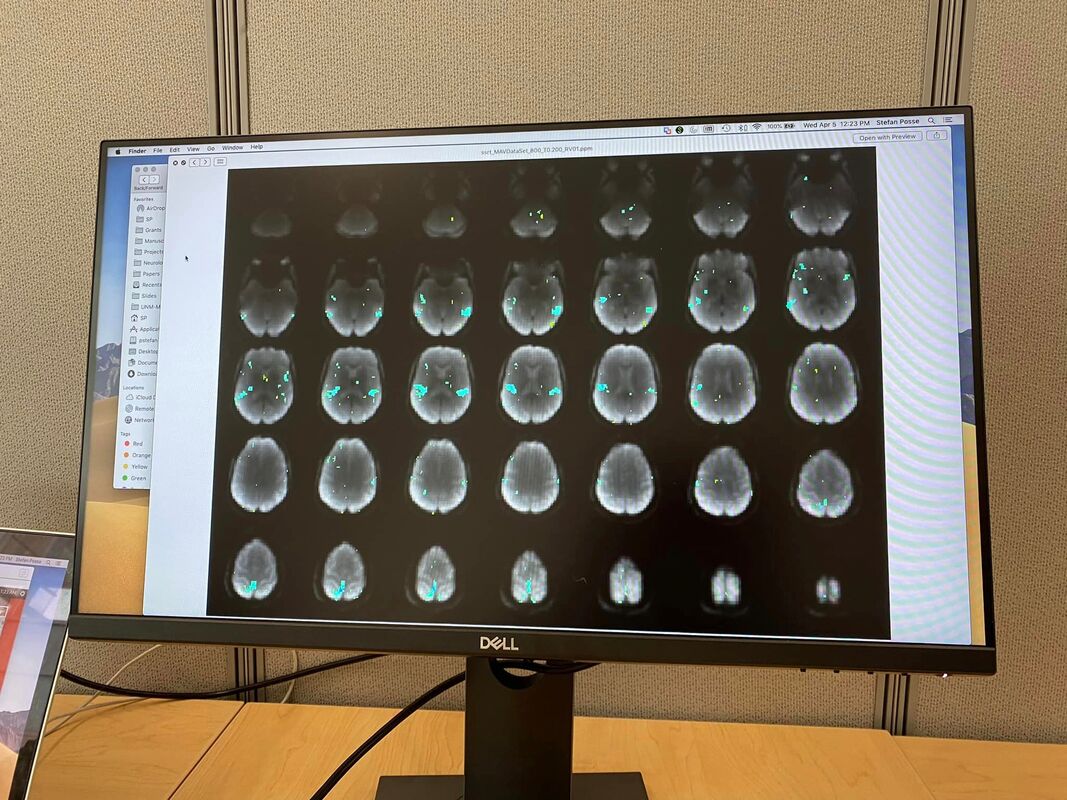 fMRI scans of brain during reflexology session